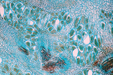 Host cells with spores (mold) are inside wood under the microscope for education.
