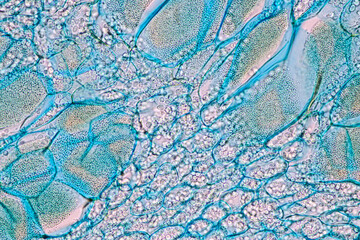 Host cells with spores (mold) are inside wood under the microscope for education.
