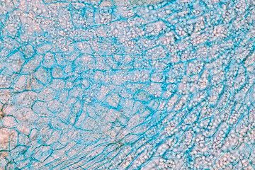 Host cells with spores (mold) are inside wood under the microscope for education.
