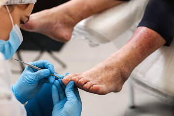 medical foot care, problems of the elderly, diseases of the feet and legs. Diseases of veins,...