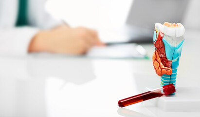 Thyroid anatomical model and thyroid hormone blood test tube on the endocrinologist's table,...