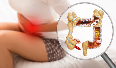 Pain in the intestines and abdomen. Dysbacteriosis, inflammation of intestines