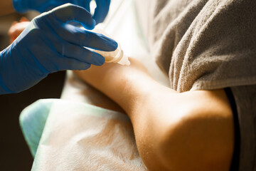 Treatment of a wound with an external antibiotic