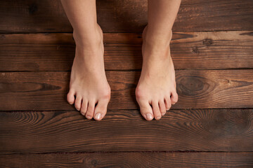 Hllux Valgus on female legs close up on wooden background