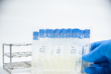 Viral transportation media (VTM)specimen collection Covid-19.