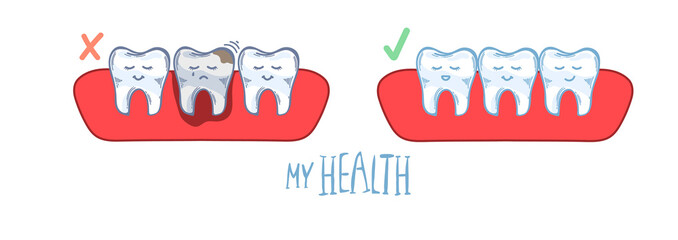 infographics. teeth in the gum, caries, damaged tooth, toothache and healthy teeth. hand drawing. Editable vector illustration in modern style. Medical concept. Keep your teeth healthy. flat desing.