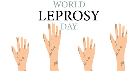 World Leprosy day vector illustration, January 31.