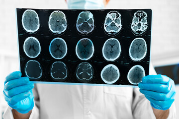 Hands of a doctor holding head mri scan