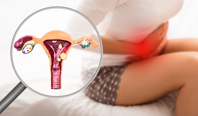 Endometriosis, virtual model of the uterus, close-up. Woman suffering from menstrual pain, while sitting on bed. Stomach pain - obrazy, fototapety, plakaty