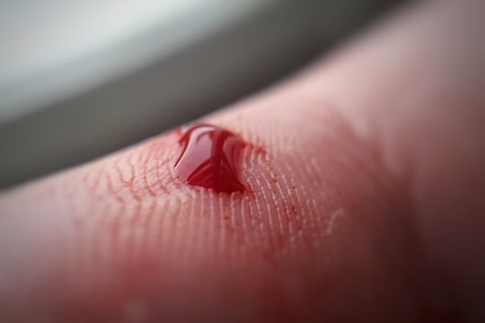 Macro of a finger with a drop of blood. Bleeding blood from the cut finger wound. Injured finger with bleeding open cut