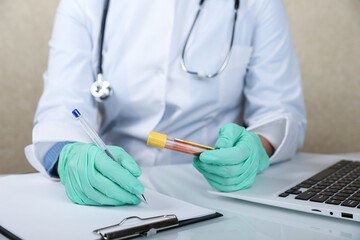 Fototapeta na wymiar doctor's hands hold blood test tube close up