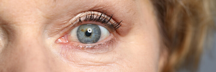 Blue eyes of an elderly woman. Healthy complexion and aging skin