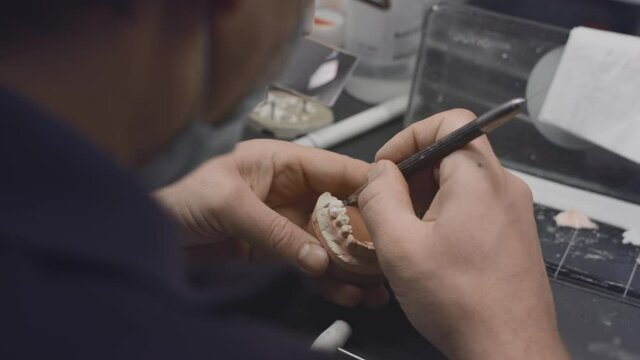 A dentist creates a model of a jaw prosthesis and ceramic teeth in the laboratory. Apply paint to dental implants with a brush. Artificial teeth. Application of new technologies in dentistry.