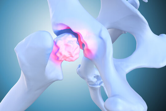 Canine Arthritis and Osteoarthritis joint inflammation,