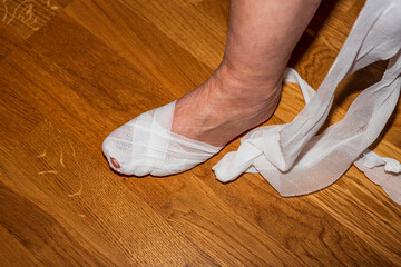 Close up view of female taking off bandage of foot with bruised big toe. Injuries and bruises concept. 