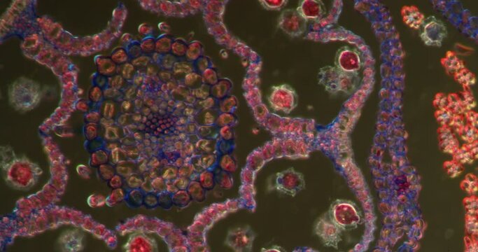 dandelion blossom in Darkfield tissue under the microscope 200x