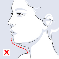 Woman profile double chin before. Woman face. Vector illustration