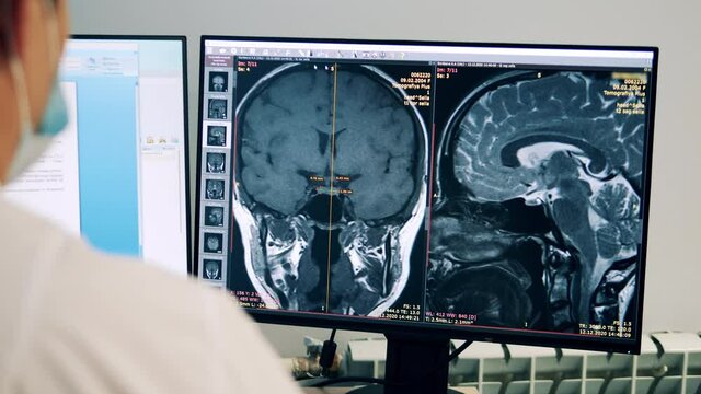 Medical worker is researching CT scan on the computer