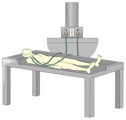 エンバーミングの「注入」工程で防腐固定液を注入する様子2　人物なし