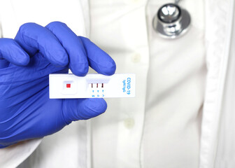 Medical worker holding positive Rapid Diagnostic Test cassette