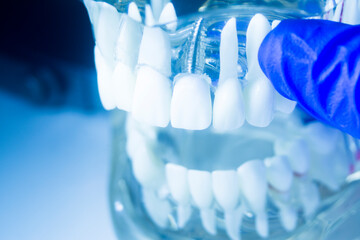 Dental tooth implant model