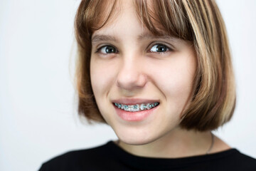 A young girl is smiling sweetly on a white background, the girl has blond short hair and has braces on her teeth, the girl is glad that now she will not be ashamed of her smile