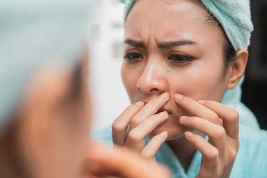 close up of asian girl squeezing pimple on the cheek to the mirror with towel on head