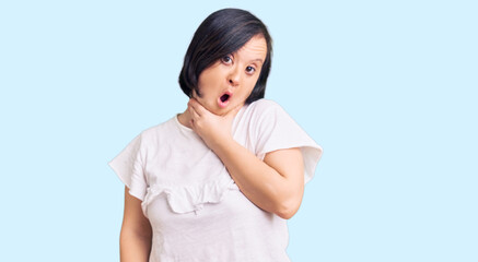 Brunette woman with down syndrome wearing casual white tshirt looking fascinated with disbelief, surprise and amazed expression with hands on chin