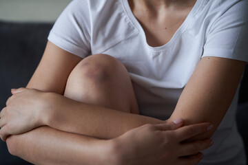Close-up of a person massaging an injured knee joint. Bruise on the knee. Leg pain