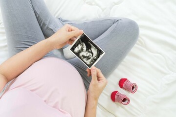 Top view of pregnant woman sitting on bed,holding x-ray image of her baby with shoes .Concept of pregnancy, Maternity prenatal care. Mom with a new life