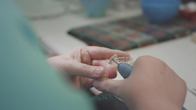 Adult female medic creates invisible braces in the laboratory. The surgeon holds the Invisalign removable in his hands. Advanced technology in dentistry. Production of artificial teeth