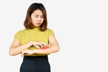 Asian woman scratching her itchy arm cause of dry skin, food and drugs allergies ,dermatitis , skin...