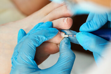 Hardware pedicure, preparation of the nail plate for applying gel polish. Master chiropody shapes...