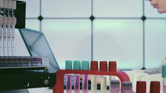 Processing of PSR tests for virus and microbes in the laboratory