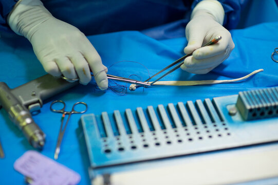Male surgeon wearing glove using tweezers and thread in operating room