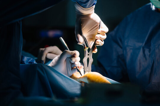 Male orthopedic surgeons using medical equipment for ankle surgery in operating room