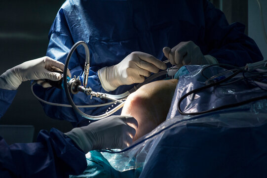 Male surgeons operating knee surgery in emergency room at hospital