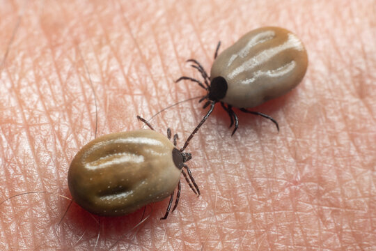 A tick drunk on blood crawls on human skin