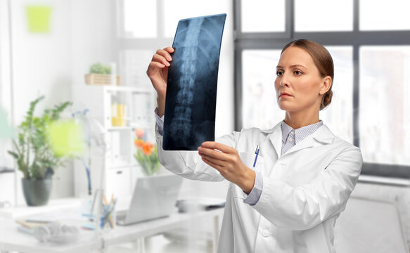 medicine, radiology and healthcare concept - female doctor in white coat with x-ray scan image of spine over medical office at hospital on background