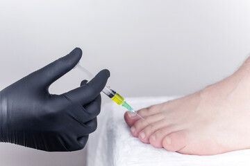 An orthopedic surgeon gives an injection in the finger joint. Treatment of osteoarthritis with hormonal drugs or drugs based on hyaluronic acid