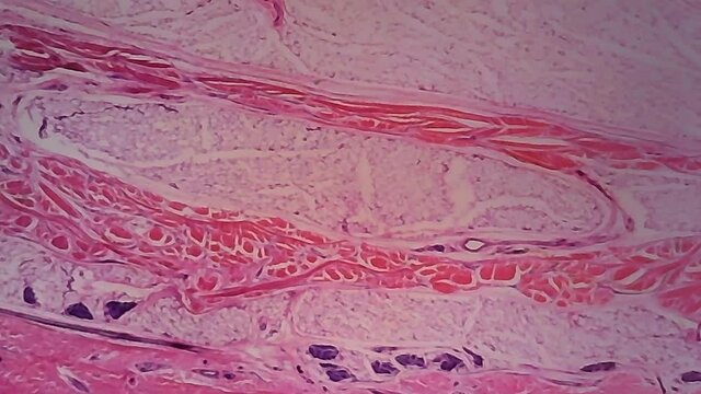 Microscope Human Skin Sweat Gland 1000x Focusing