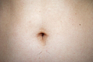 
Female belly with hair near the navel.
Hair removal concept.Before epilation. Close-up. Woman with high testosterone.