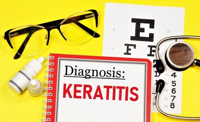 Keratitis is an inflammation of the cornea of the eye. Text inscription of the ophthalmological diagnosis. Treatment with procedures and medications.