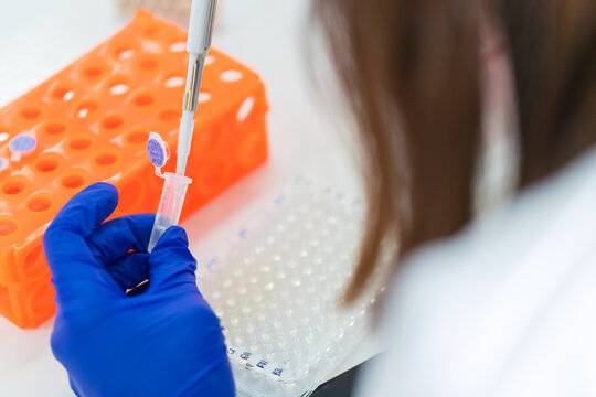 Scientist pepetting solution to dialysis tibe.