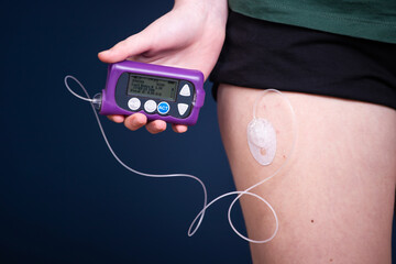 Detail of a hand holding an insulin pump - focus on insulin pump