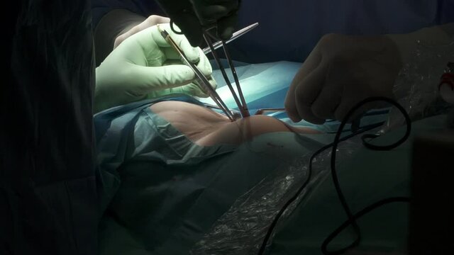Faceless doctors stitching incision after breast plastic surgery