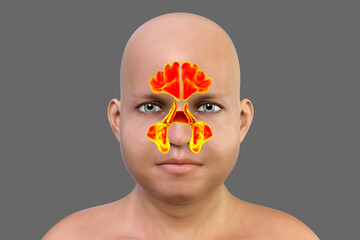 Anatomy of paranasal sinuses