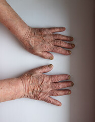 hands of an elderly woman on a white table. wrinkled hands. hands on white background