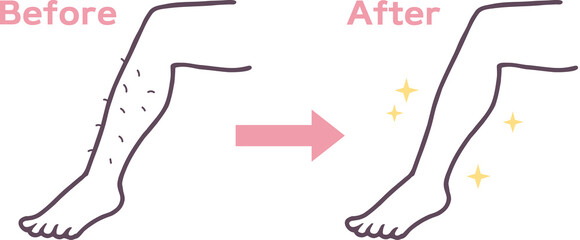 脱毛した足のビフォーアフターイラスト素材