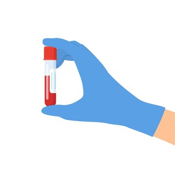 Doctor Hand holding test tube with blood isolated on white. Medical background, advertising websites. Laboratory research. Equipment for analysis. Vector illustration in flat style